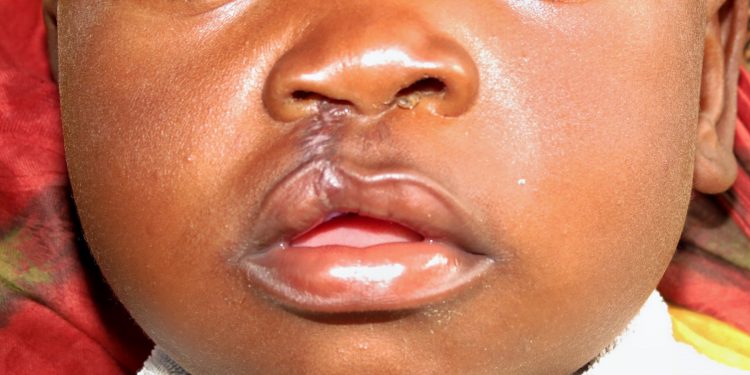 LIBERTY SURGICAL CAMPAIGN: