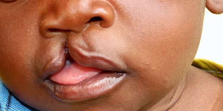 LIBERTY SURGICAL CAMPAIGN: